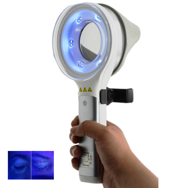 Hauterkrankungsdiagnosegerät D – Led Medical Headlight Bewertung und Preis